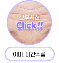 Button 1